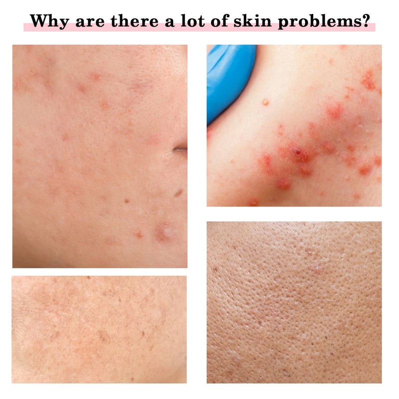 Zyre Radiance Pro